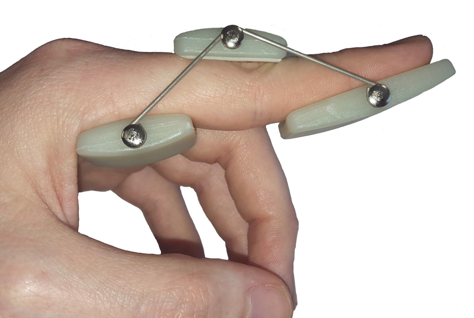 Dip Splint Finger at Allan Swindler blog